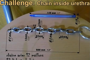 Challenge: Wire inside urethra