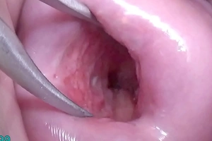 Japanese Wife Above-board Cervix Wide to watch dominant Uterus